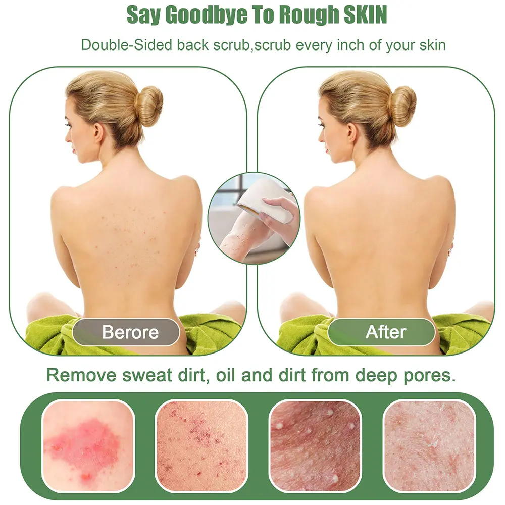 BS1090G-Back Scrubber — yechi`s Site
